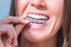 Invisalign Providers